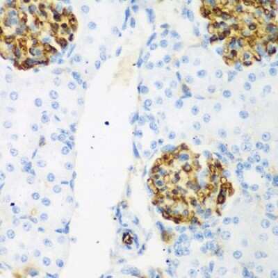 Immunohistochemistry-Paraffin: AXUD1 Antibody - BSA Free [NBP3-03327]