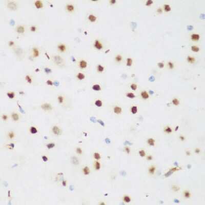 Immunohistochemistry-Paraffin: AXUD1 Antibody - BSA Free [NBP3-03327]