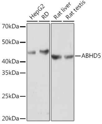 Western Blot: Abhd5 Antibody (2K8W9) [NBP3-16675]