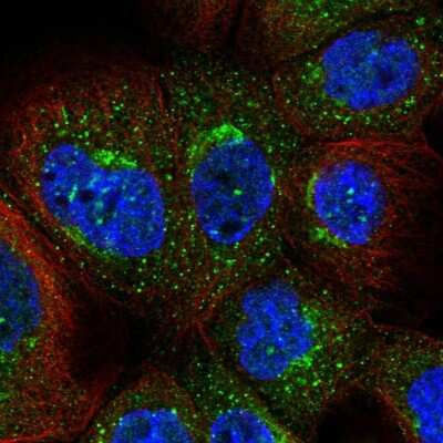 Immunocytochemistry/ Immunofluorescence: Abhd5 Antibody [NBP1-84506]