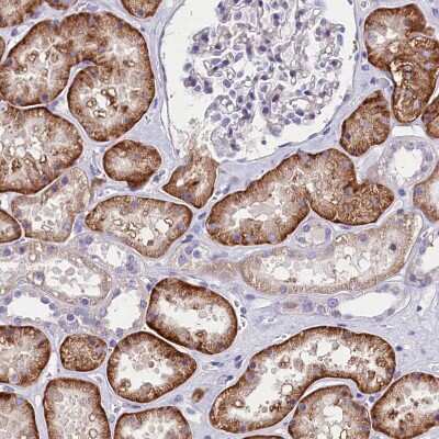 Immunohistochemistry-Paraffin: Abhd5 Antibody [NBP1-84507]