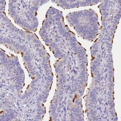 Immunohistochemistry-Paraffin: Abhd5 Antibody [NBP1-84507]
