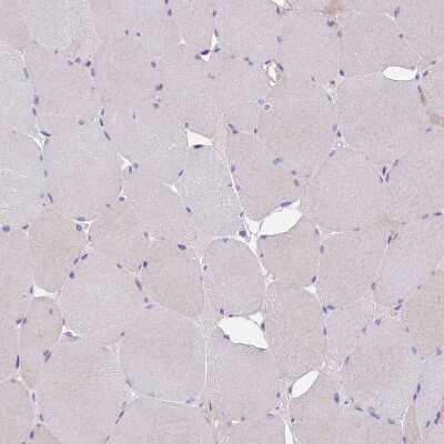 Immunohistochemistry-Paraffin: Abhd5 Antibody [NBP1-84507]