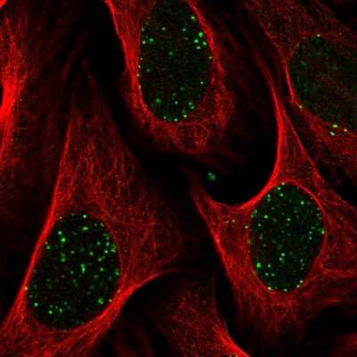 Immunocytochemistry/ Immunofluorescence: Abraxas Antibody [NBP2-38356]