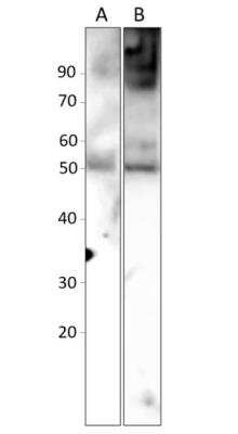 Western Blot: Abraxas Antibody [NBP3-12376]