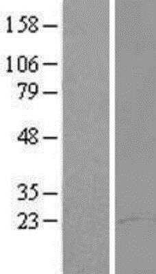 Western Blot: Abraxas Overexpression Lysate [NBP2-05609]