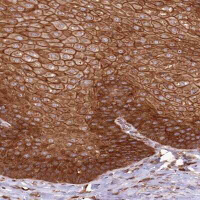 Immunohistochemistry: Absent in melanoma 1 Antibody [NBP2-38170]