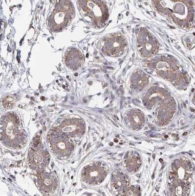 Immunohistochemistry-Paraffin: Acetyl-CoA Carboxylase alpha/ACACA Antibody [NBP2-38981]