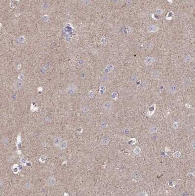 Immunohistochemistry-Paraffin: Acetyl-CoA Carboxylase alpha/ACACA Antibody [NBP2-38981]