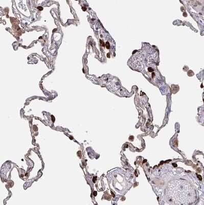 Immunohistochemistry-Paraffin: Acetyl-CoA Carboxylase alpha/ACACA Antibody [NBP2-38981]