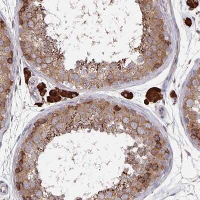 Immunohistochemistry-Paraffin: Acetyl-CoA Carboxylase alpha/ACACA Antibody [NBP2-38981]
