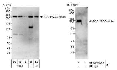 Western Blot: Acetyl-CoA Carboxylase alpha/ACACA Antibody [NB100-55247]