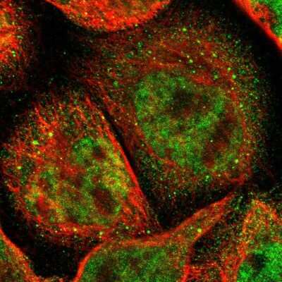 Immunocytochemistry/ Immunofluorescence: Acetyl CoA synthetase Antibody [NBP1-90276]