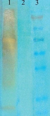 Western Blot: Acetyl-Lysine Antibody (7F8) [NB110-96876]