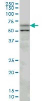Western Blot: Acetyl-coenzyme A transporter 1 Antibody (3A4) [H00009197-M07]