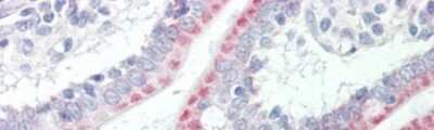 Immunohistochemistry: Acetyl-coenzyme A transporter 1 Antibody [NBP1-59882]