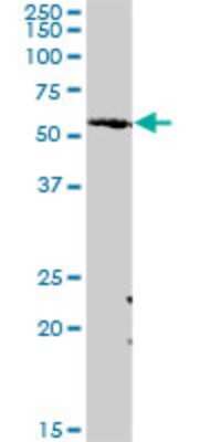 Western Blot: Acetyl-coenzyme A transporter 1 Antibody [H00009197-D01P]