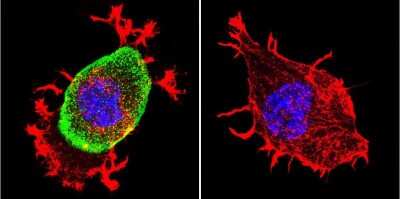 Immunocytochemistry/ Immunofluorescence: Acetylcholinesterase/ACHE Antibody (HR2) - BSA Free [NB300-528]