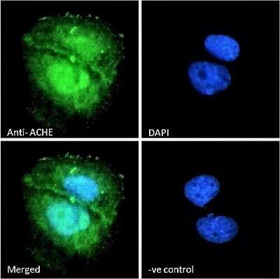 Immunocytochemistry/ Immunofluorescence: Acetylcholinesterase/ACHE Antibody [NB100-1519]