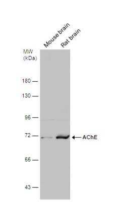 Western Blot: Acetylcholinesterase/ACHE Antibody [NBP1-31329]