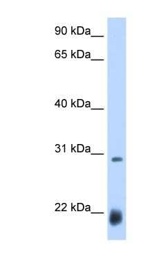 Western Blot: Achaete Antibody [NBP1-79448]