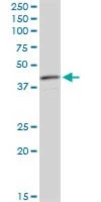 Western Blot: Acidic Calponin Antibody (4C4) [H00001266-M01]