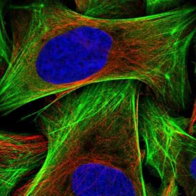 Immunocytochemistry/ Immunofluorescence: Acidic Calponin Antibody [NBP2-38643]