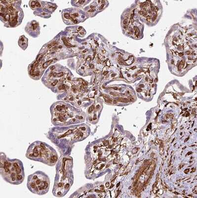 Immunohistochemistry-Paraffin: Acidic Calponin Antibody [NBP2-38643]