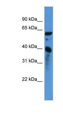 Western Blot: Acidic Calponin Antibody [NBP1-68944]