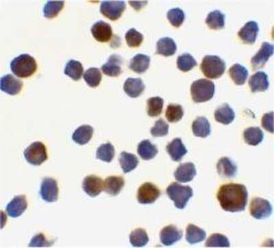 Immunocytochemistry/ Immunofluorescence: Acinus Antibody - BSA Free [NBP1-76856]