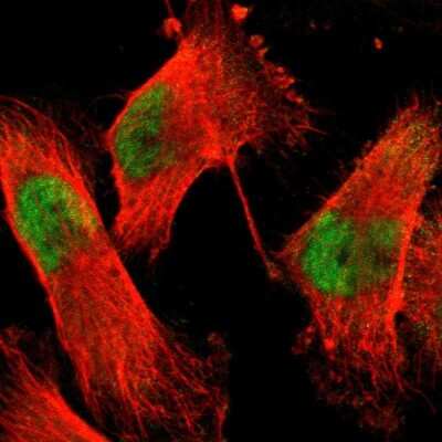 Immunocytochemistry/ Immunofluorescence: Acinus Antibody [NBP1-90823]