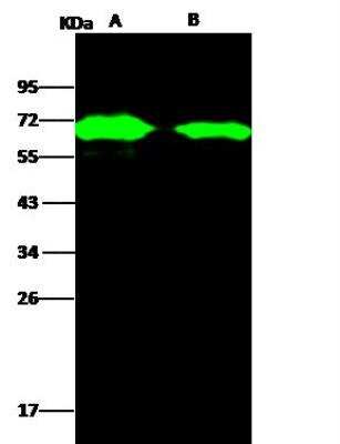Western Blot: AcmNPV gp64 Protein Antibody [NBP3-12764]