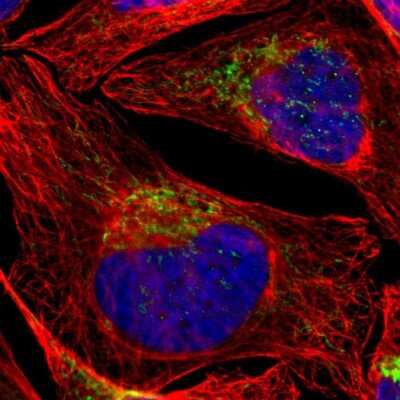 Immunocytochemistry/ Immunofluorescence: Aconitase 2 Antibody [NBP1-90264]