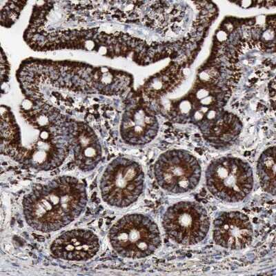 Immunohistochemistry-Paraffin: Aconitase 2 Antibody [NBP1-90264]