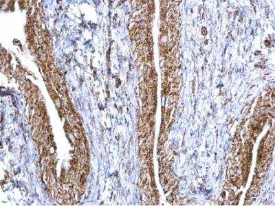Immunohistochemistry-Paraffin: Aconitase 2 Antibody [NBP2-15245]