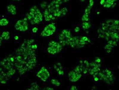 Immunocytochemistry/ Immunofluorescence: Aconitase 2 Antibody (OTI3G8) - Azide and BSA Free [NBP2-70074]