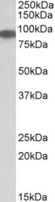 Western Blot: Aconitase 2 Antibody [NBP1-52014]