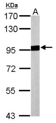 Western Blot: Aconitase 2 Antibody [NBP2-15245]