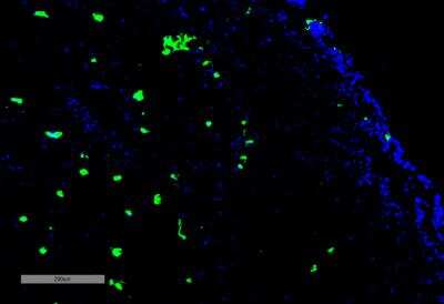 Immunohistochemistry: Acrolein Antibody (10A10) [NBP2-59359]