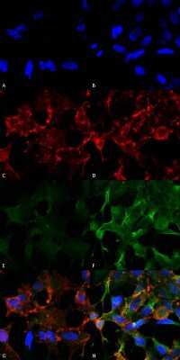 Immunocytochemistry/ Immunofluorescence: Acrolein Antibody (2H2) [NBP2-59358]