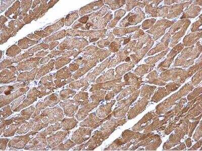 Immunohistochemistry-Paraffin: Actin Alpha 1 Cardiac Muscle Antibody [NBP1-33759]