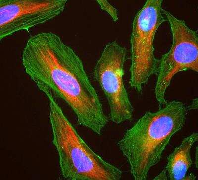Immunocytochemistry/ Immunofluorescence: pan Actin Antibody (5J11) [NBP2-25142]