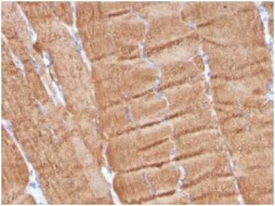 Immunohistochemistry-Paraffin: Actin Antibody (ACTA1/360) [NBP3-13759]