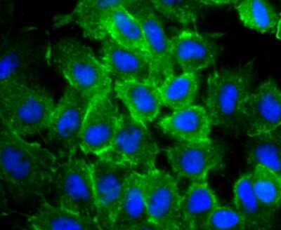 Immunocytochemistry/ Immunofluorescence: Actin Antibody (JJ09-29) [NBP2-67907]