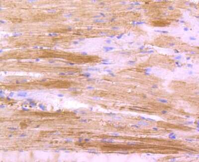 Immunohistochemistry-Paraffin: Actin Antibody (JJ09-29) [NBP2-67907]
