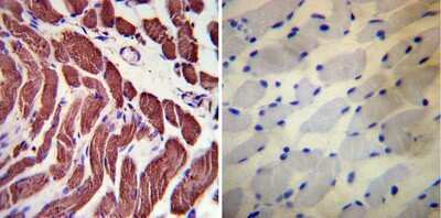 Immunohistochemistry-Paraffin: Actin Antibody (mAbGEa) [NB100-74340]