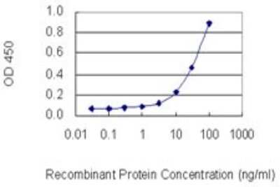 ELISA: Actin Gamma 1 Antibody (1G6) [H00000071-M01]