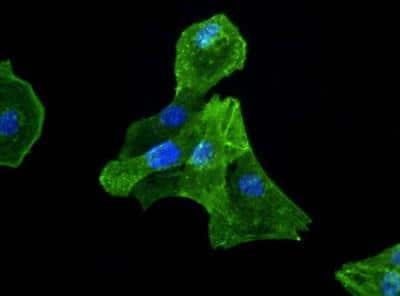 Immunocytochemistry/ Immunofluorescence: Actin Gamma 1 Antibody [NB600-533]