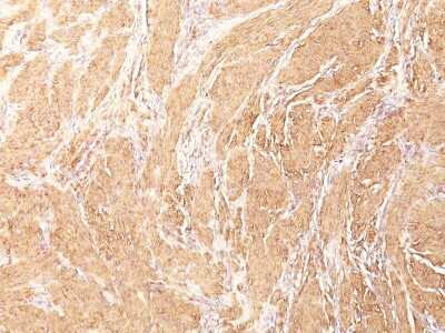 Immunohistochemistry-Paraffin: Actin (Muscle Specific) Antibody (HHF35) [NBP2-34230]