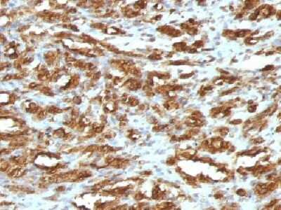 Immunohistochemistry-Paraffin: Actin (Muscle Specific) Antibody (HHF35) [NBP2-34230]